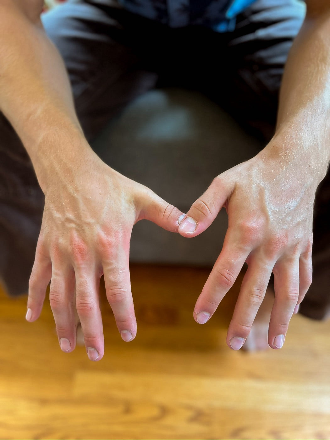 A pair of dry, hard-working hands shown palms-down